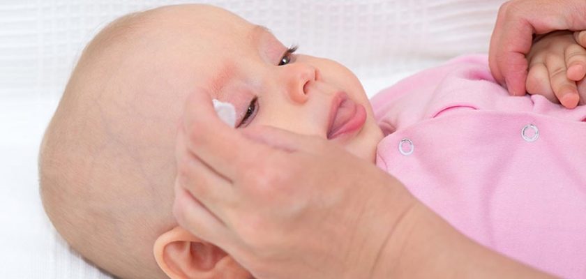Bebeklerde Göz Temizliği Nasıl Yapılır?