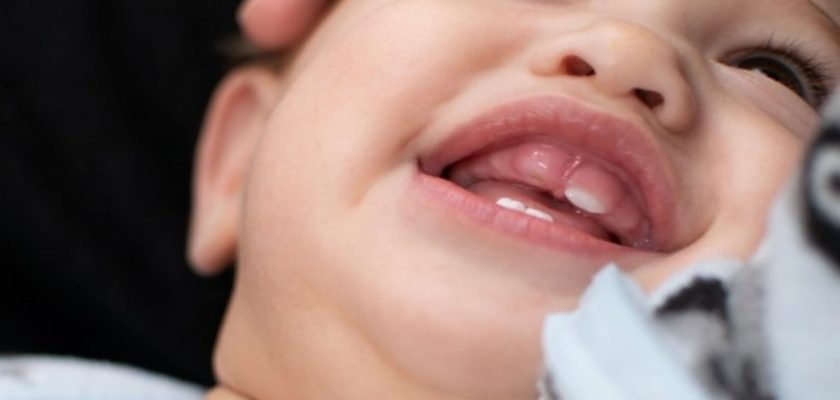 Bebeklerde Önce Hangi Diş Çıkar?