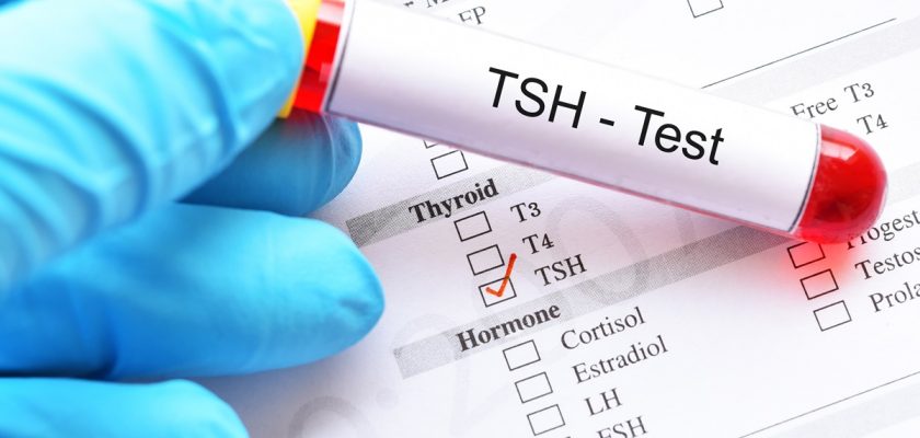 Tsh Nedir?